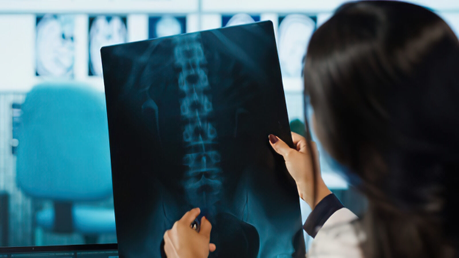 Female Doctor Examining Spinal X-Ray Image