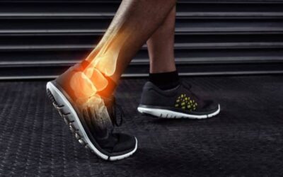 Persistent Ankle Pain After a Sprain? It Could Be More Serious Than You Think