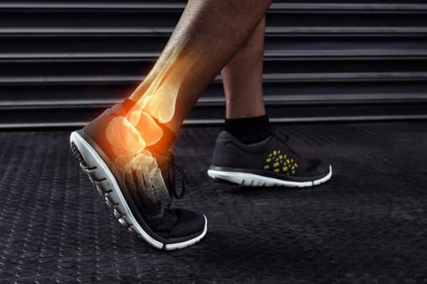 Persistent Ankle Pain After a Sprain